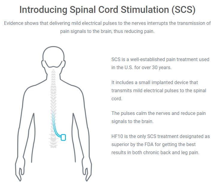 Spinal Cord Stimulator Trial