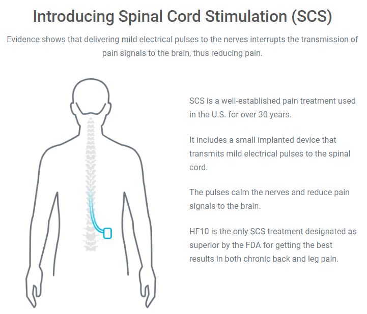 Spinal cord stimulation